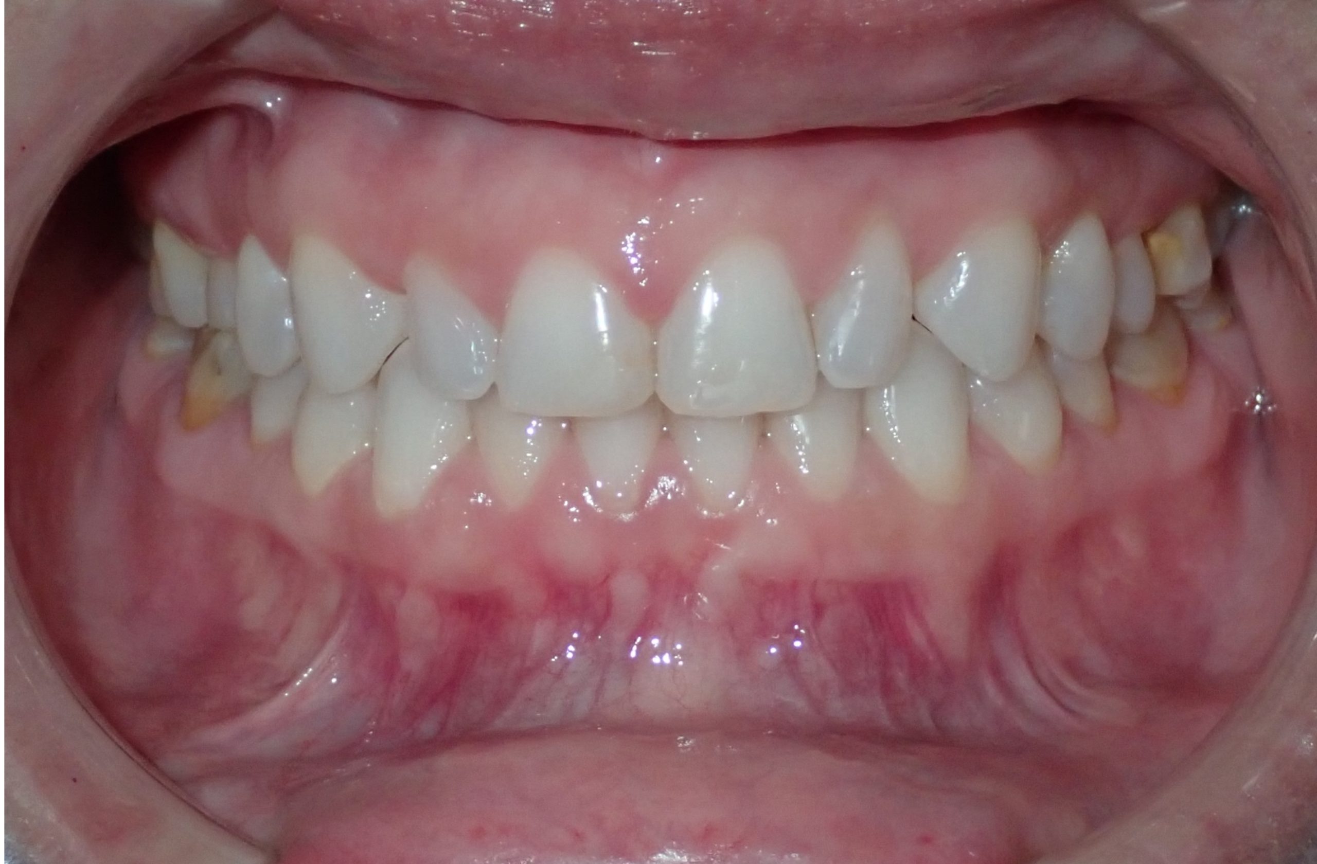 Burlington Orthodontics