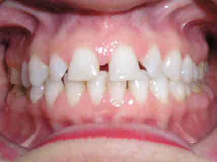 Burlington Orthodontics