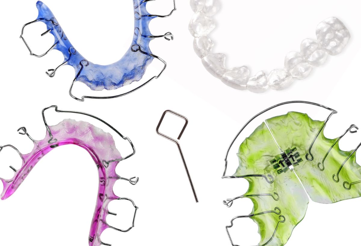 what-you-need-to-know-about-retainers